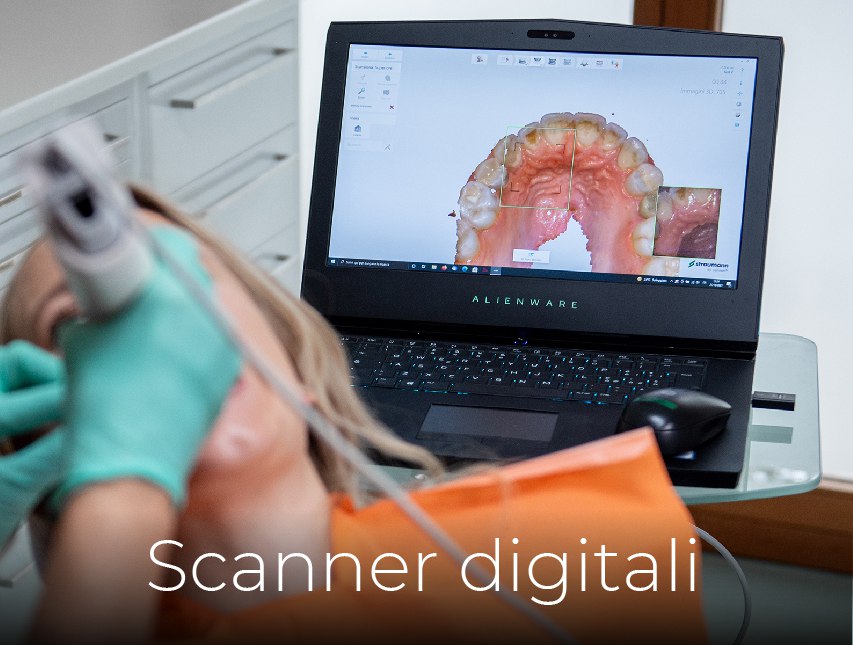 Scanner intraorale - Centro Dentistico Arese