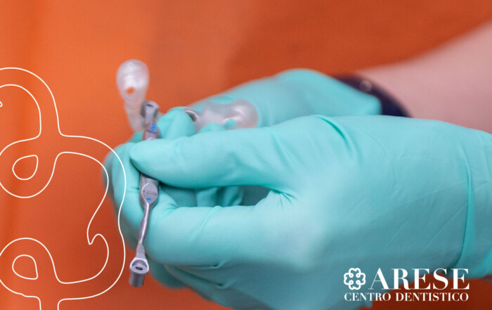 impianti dentali denti fissi